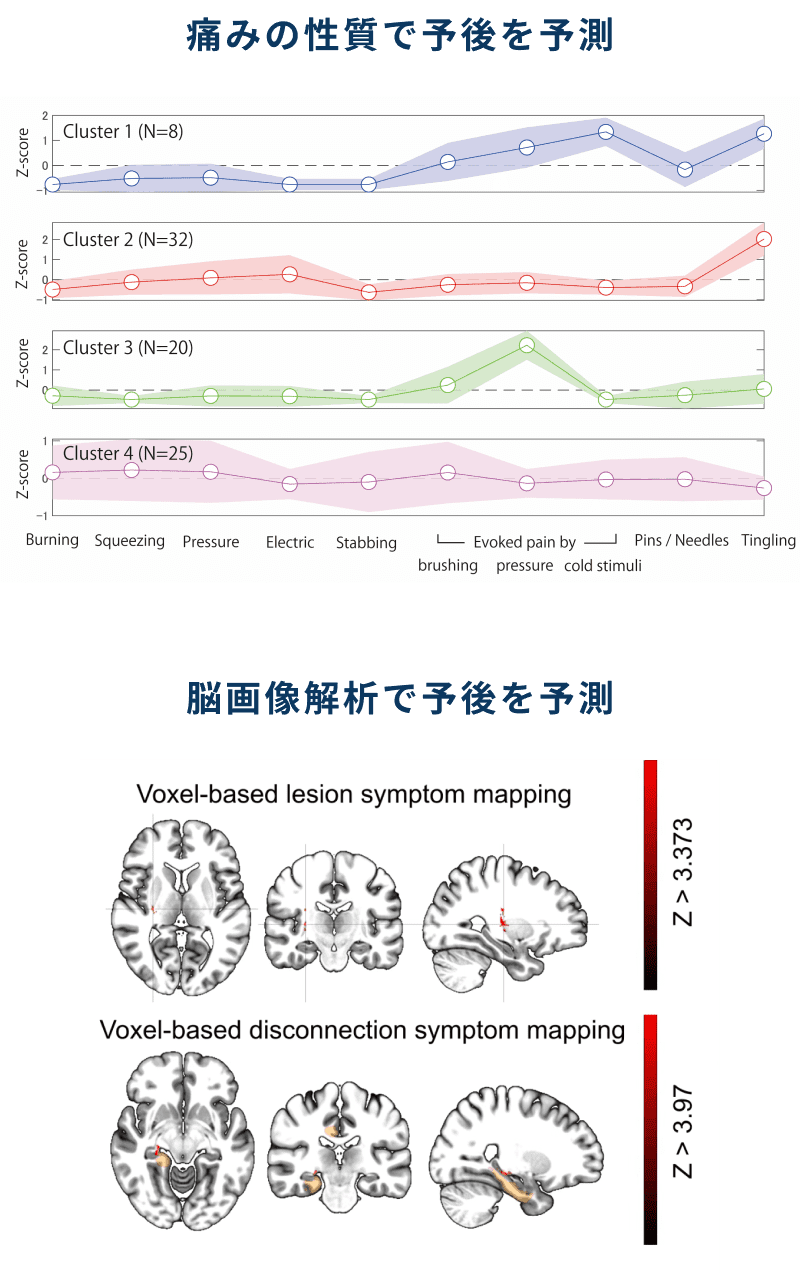 痛みの性質で予後を予測するための実験結果のグラフと脳画像