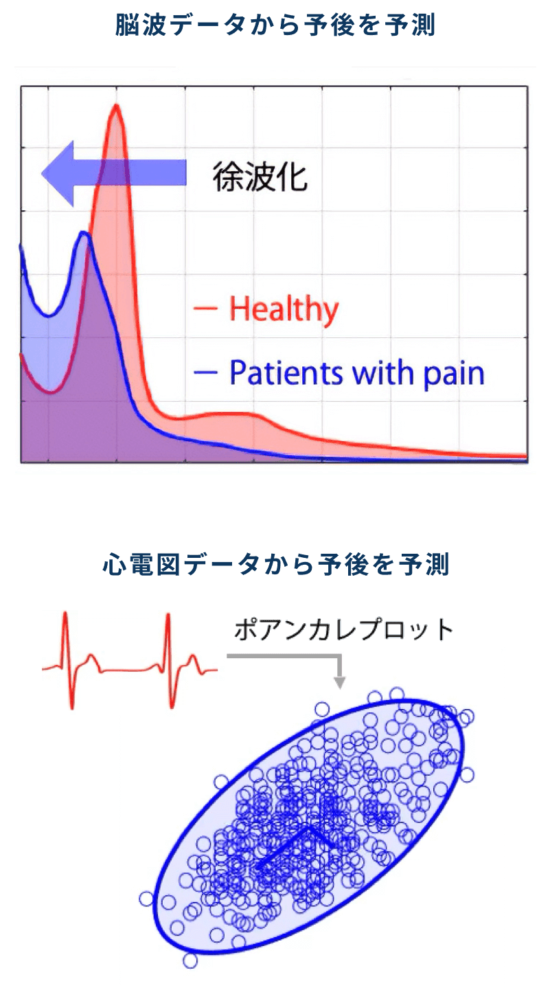 脳波データのグラフと心電図データから予後を予測するイメージ図